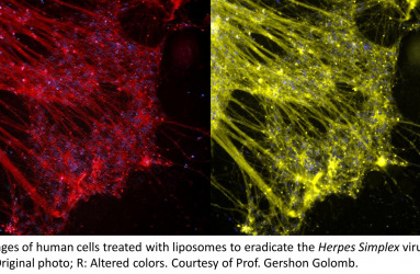 Human Cells