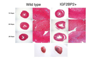 rna binding protien