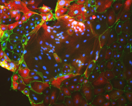 Credit: Moriyah Naama, Buganim Lab