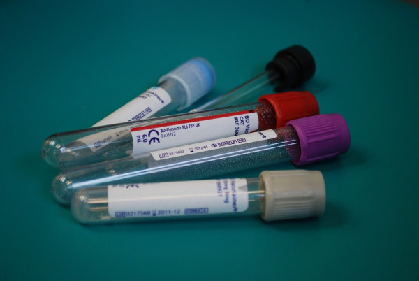 Safer Therapy for Pulmonary Embolism